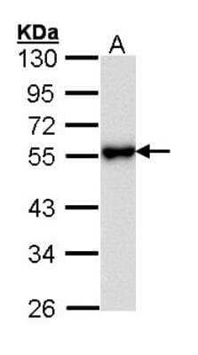 Western Blot: KiSS1R/GPR54 Antibody [NBP2-16723]