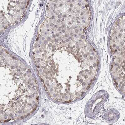 Immunohistochemistry-Paraffin: Kidney-associated antigen 1 Antibody [NBP1-87106]