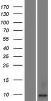 Western Blot: Kidney-associated antigen 1 Overexpression Lysate [NBP2-04931]