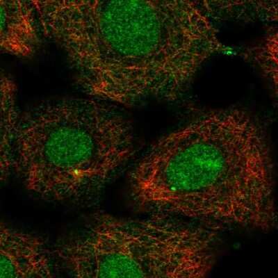 Immunocytochemistry/ Immunofluorescence: Kif2a Antibody [NBP2-55116]