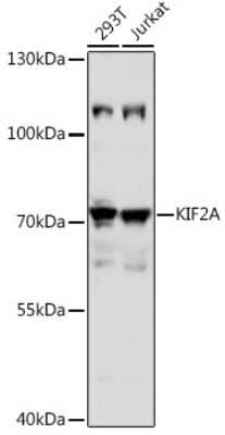 Western Blot: Kif2a AntibodyAzide and BSA Free [NBP3-04946]