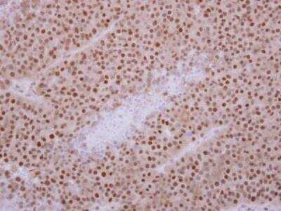 Immunohistochemistry-Paraffin: Kif3c Antibody [NBP2-17055]