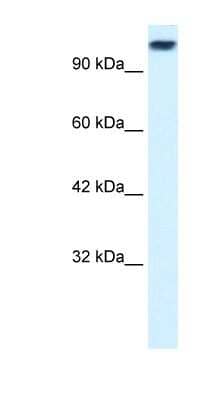 Western Blot: Kif3c Antibody [NBP1-58193]