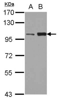 Western Blot: Kif3c Antibody [NBP2-17055]