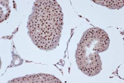 Immunohistochemistry-Paraffin: Kif4A Antibody (4A9P2) [NBP3-16748]