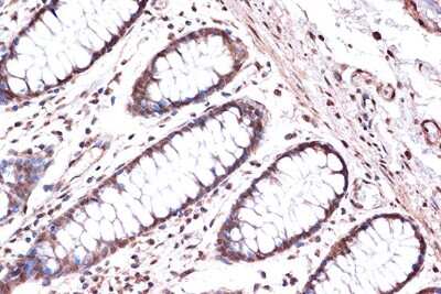 Immunohistochemistry-Paraffin: Kif4A Antibody (4A9P2) [NBP3-16748]