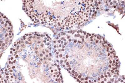 Immunohistochemistry-Paraffin: Kif4A Antibody (4A9P2) [NBP3-16748]