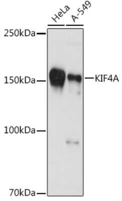 Western Blot: Kif4A Antibody (4A9P2) [NBP3-16748]