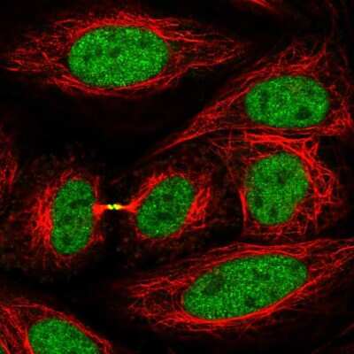 Immunocytochemistry/ Immunofluorescence: Kif4A Antibody [NBP2-56589]