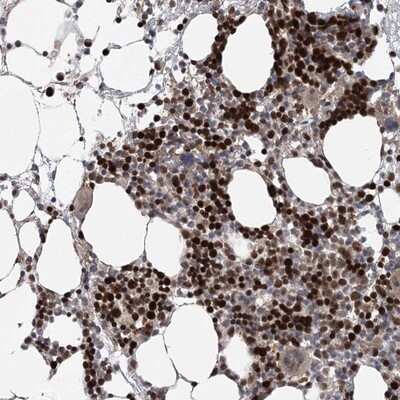Immunohistochemistry-Paraffin: Kif4A Antibody [NBP1-83721]