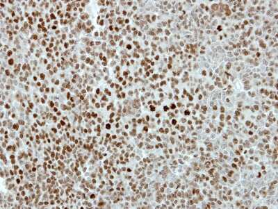 Immunohistochemistry-Paraffin: Kif4A Antibody [NBP2-17056]