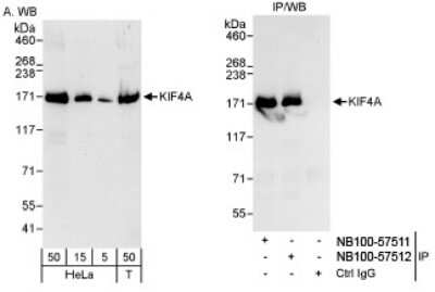 Western Blot: Kif4A Antibody [NB100-57512]