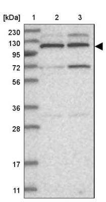 Western Blot: Kif4A Antibody [NBP1-83720]