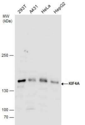 Western Blot: Kif4A Antibody [NBP2-17056]