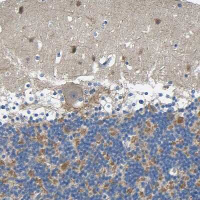 Immunohistochemistry-Paraffin: Kilon/NEGR1 Antibody [NBP1-83116]