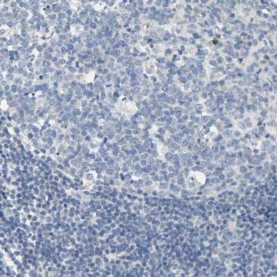 Immunohistochemistry-Paraffin: Kilon/NEGR1 Antibody [NBP1-83116]