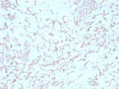 Immunohistochemistry-Paraffin: Kindlin Antibody (4A5.14) - Azide and BSA Free [NBP3-08647]