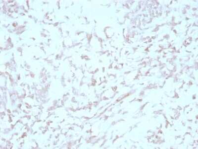 Immunohistochemistry-Paraffin: Kindlin Antibody (4A5.14) [NBP3-07696]