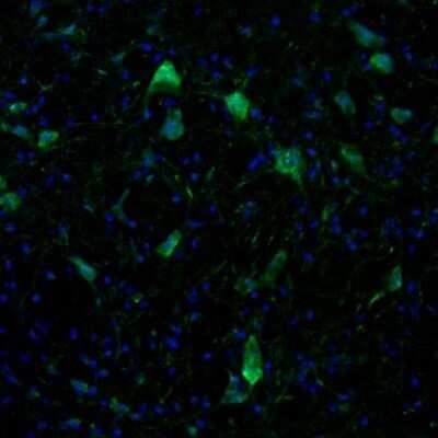 Immunohistochemistry: Kinesin 5A Antibody [NBP1-85344]