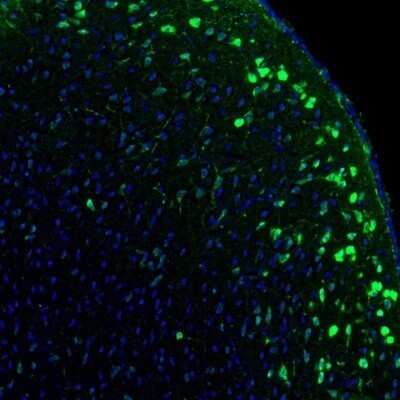 Immunohistochemistry: Kinesin 5A Antibody [NBP1-85344]