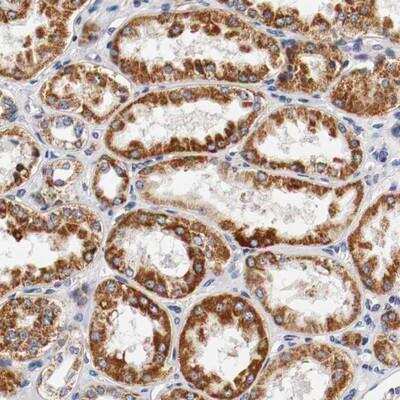 Immunohistochemistry-Paraffin: Kinesin 5A Antibody [NBP1-85344]