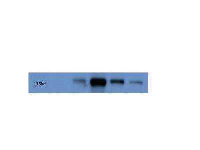 Western Blot: Kinesin 5A AntibodyBSA Free [NBP1-76816]
