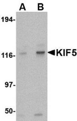 Western Blot: Kinesin 5A AntibodyBSA Free [NBP1-76817]