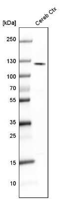 Western Blot: Kinesin 5A Antibody [NBP1-85344]