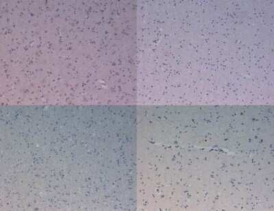 Immunohistochemistry: Kinesin 5B Antibody [NBP2-21667]