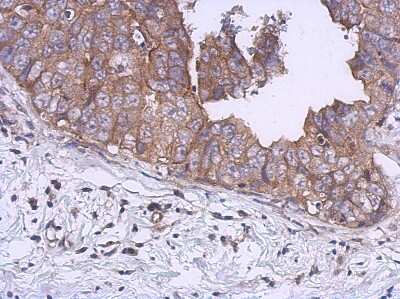Immunohistochemistry-Paraffin: Kinesin 5B Antibody [NBP1-31022]