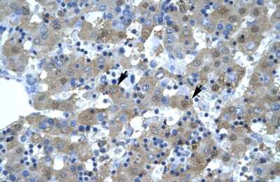 Immunohistochemistry-Paraffin: Kinesin 5B Antibody [NBP1-58177]