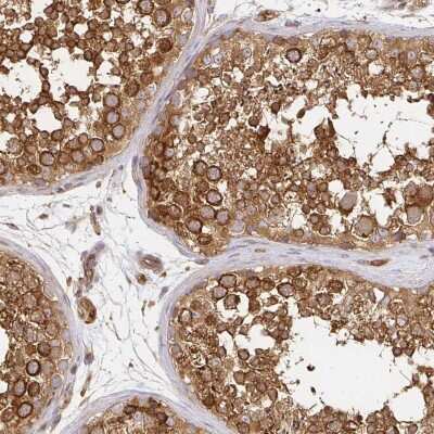 Immunohistochemistry-Paraffin: Kinesin 5B Antibody [NBP2-58450]