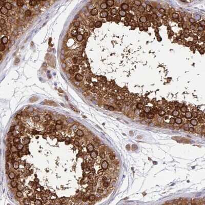 Immunohistochemistry-Paraffin: Kinesin 5B Antibody [NBP2-58451]