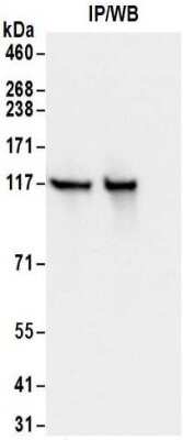 Immunoprecipitation: Kinesin 5B Antibody [NBP2-32278]