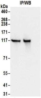 Immunoprecipitation: Kinesin 5B Antibody [NBP2-32279]