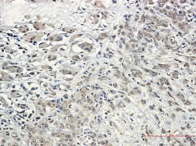 Immunohistochemistry-Paraffin: Kinesin 5B Antibody (S04-6G8) [NBP3-14868]
