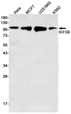 Western Blot: Kinesin 5B Antibody (S04-6G8) [NBP3-14868]