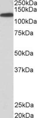 Western Blot: Kinesin 5B Antibody [NB100-1059]