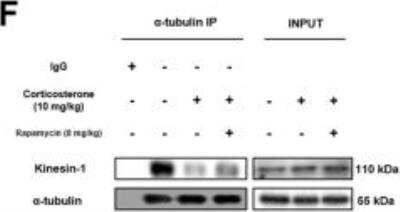 Western Blot: Kinesin 5B Antibody [NBP2-21667]