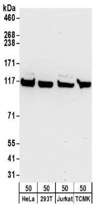 Western Blot: Kinesin 5B Antibody [NBP2-32278]