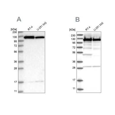 Western Blot: Kinesin 5B Antibody [NBP2-58450]