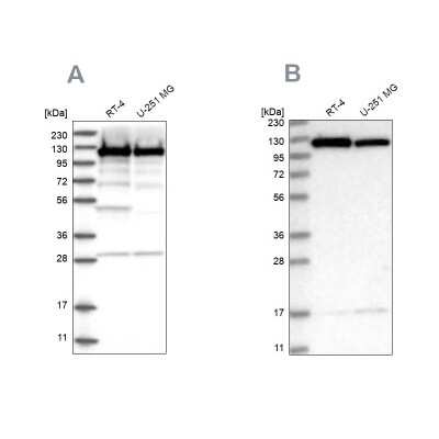 Western Blot: Kinesin 5B Antibody [NBP2-58451]