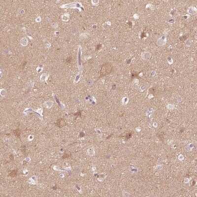 Immunohistochemistry-Paraffin: Kinesin 5C Antibody [NBP1-87429]