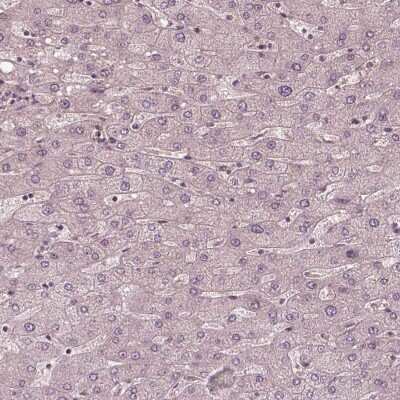 Immunohistochemistry-Paraffin: Kinesin 5C Antibody [NBP1-87429]