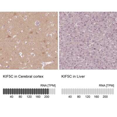 Immunohistochemistry-Paraffin: Kinesin 5C Antibody [NBP1-87429]