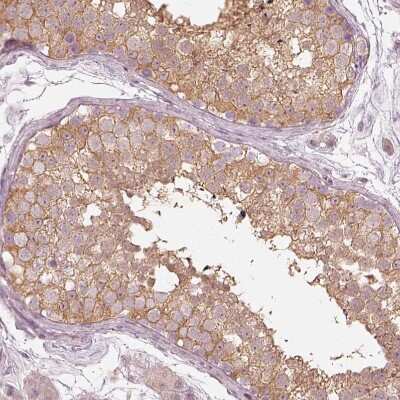 Immunohistochemistry-Paraffin: Kinesin 5C Antibody [NBP1-87429]