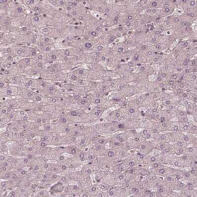 Immunohistochemistry-Paraffin: Kinesin 5C Antibody [NBP1-87429]