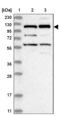 Western Blot: Kinesin 5C Antibody [NBP1-87429]