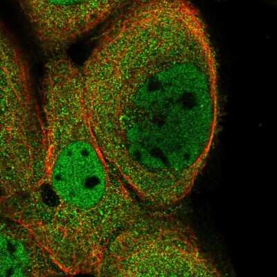 Immunocytochemistry/ Immunofluorescence: Kinesin C2 Antibody [NBP1-87535]