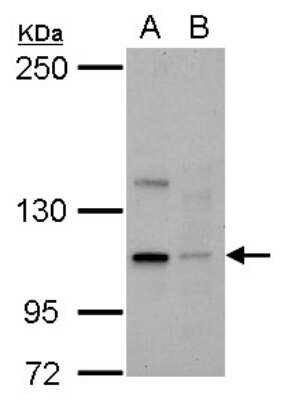 Western Blot: Kinesin C2 Antibody [NBP2-17061]